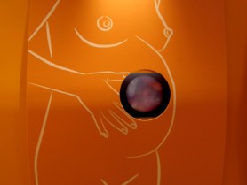 EL CORDÓ UMBILICAL. Font de vida